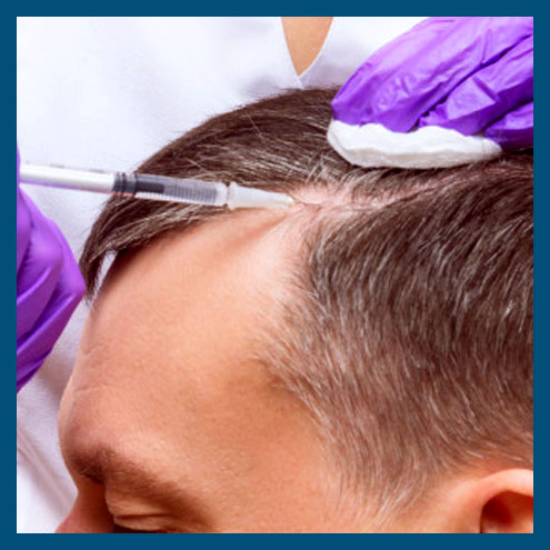 Most Reliable Hair Transplant Treatment Service