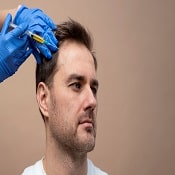 PRP Hair Treatment